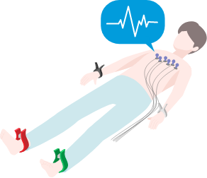 ECG